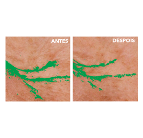 Creme de Olhos Antirrugas & Antipapos | Yves Rocher Portugal 