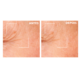 Concentrado Dupla Ação Antirrugas + Efeito Pele Nova  | Yves Rocher Portugal